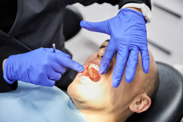 Best Broken or Chipped Tooth Repair in Strasburg, OH